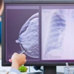Prognostic Testing