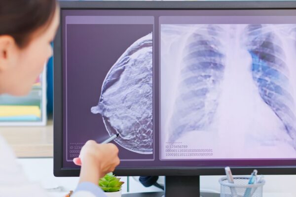 Prognostic Testing